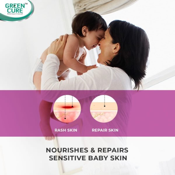 NappCure - For delicate baby skin, best baby rash cream